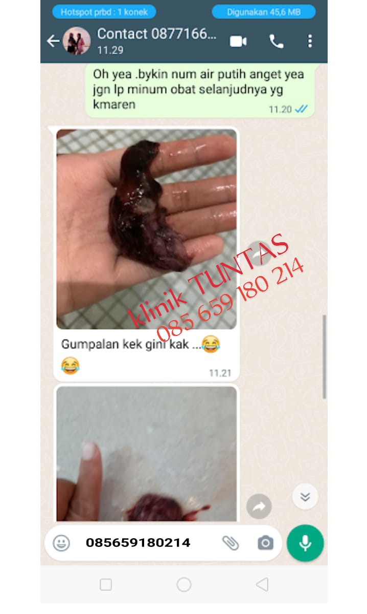 Testimoni setelah menggunakan Obat